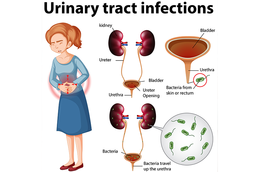 informative-illustration-urinary-tract-infections